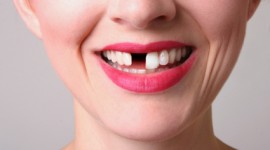 Smile Africa - Dentists Dealing With Missing Teeth In Kenya