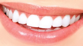 Smile Africa - Professional Teeth Whitening Treatment in Kenya