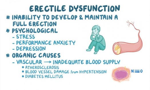 ERECTILE DYSFUNCTION DIAGNOSIS TREATMENT IN NAIROBI Dr