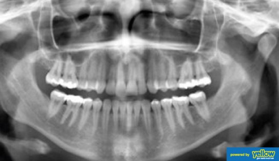 Family Dentistry - Pick Intraoral X-ray Services For Significant Patient Comfort