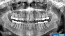 Family Dentistry - Pick Intraoral X-ray Services For Significant Patient Comfort