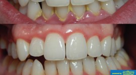 Swedish Dental Clinic, SDC - Healthy Gums For A Healthy Smile