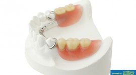 Family Dentistry - Consider A More Natural-Look For Teeth Replacement.