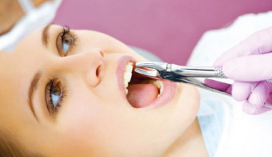 Family Dentistry - Professional Tooth Extraction Services