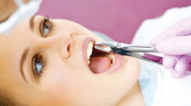 Family Dentistry - Professional Tooth Extraction Services