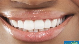 Swedish Dental Clinic, SDC - Experts In Gum Diseases Treatment...