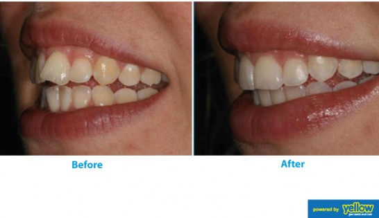 Swedish Dental Clinic, SDC - Cosmetic dentistry procedures for a prefect smile