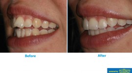Swedish Dental Clinic, SDC - Cosmetic dentistry procedures for a prefect smile