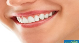 Family Dentistry - Tips on Keeping Those Teeth & Gums Healthy... 