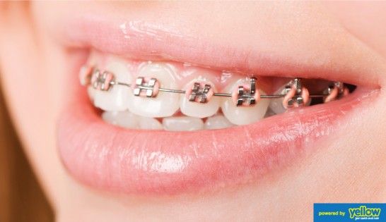 Swedish Dental Clinic, SDC - Get first class treatment for your crooked or mal-positioned teeth