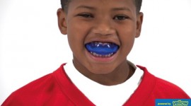 Family Dentistry - Stay safe in the game with custom mouth guards