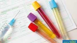 Nyumbani Diagnostic Laboratory - Professional Serology test available