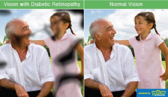 Sharp Vision  - Helping you prevent diabetic retinopathy.