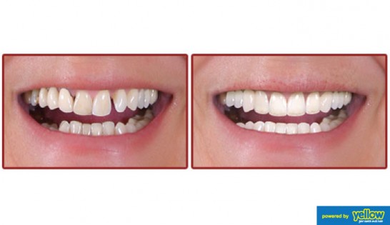 Family Dentistry - Providing dental contouring and reshaping.