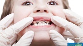 Family Dentistry - We Will Help Your Child Stay Away From Cavity…