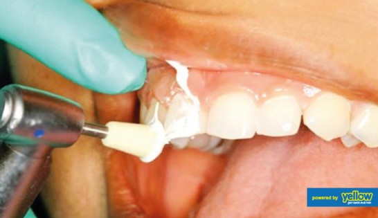 Smile Africa - Scaling and polishing procedures for effective teeth cleaning