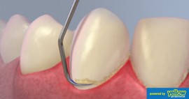 Dental Health Providers Clinics - Teeth Scaling By Experts in Nairobi