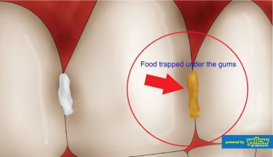 Swedish Dental Clinic, SDC - Helping You Prevent Gum And Periodontal Diseases.