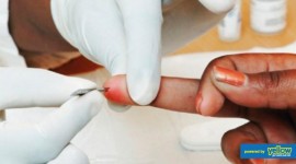 Nyumbani Diagnostic Laboratory - Laboratory Testing & Monitoring of HIV/AIDS Disease
