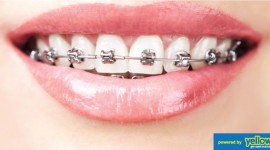 All Smiles Dental Practice - Get Variety Treatment For Crooked Teeth Or Misaligned Bite.