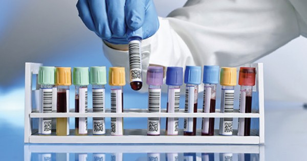 Nyumbani Diagnostic Laboratory - Nyumbani diagnostic Endocrinology testing