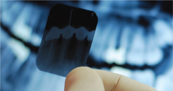 Family Dentistry - Clear, Fast Dental X-Ray Services...