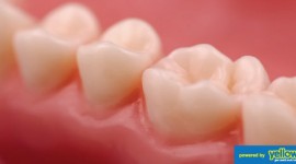 Dental Health Providers Clinics - Get a fast, reliable gum therapy service from us