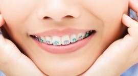 Balm Dental Care Centre  - Dental Braces For Adults 