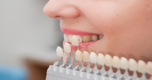 Swedish Dental Clinic, SDC - Professional Dental Veneer Services in Nairobi, Kenya