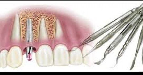 Dental Health Providers Clinics - Professional Oral Surgery Clinic In Nairobi, Kenya