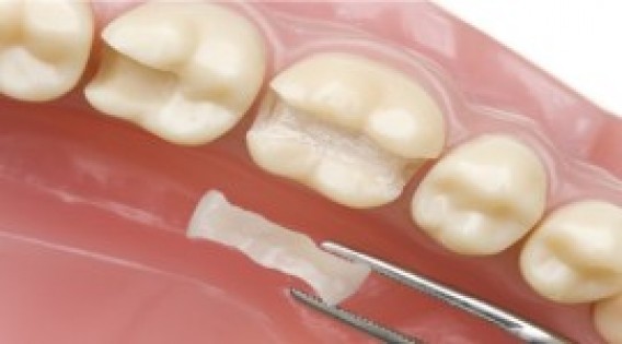 Balm Dental Care Centre  - Dental Fillings In Kenya 