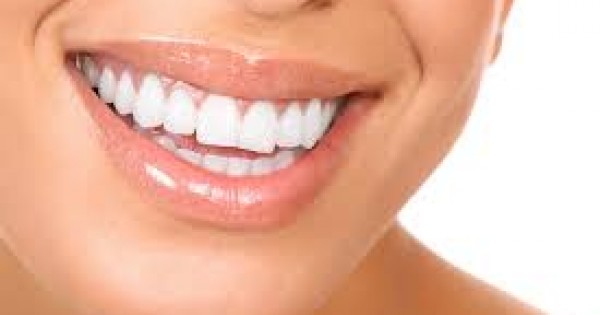 All Smiles Dental Practice - Dental Bonding Services In Kenya 