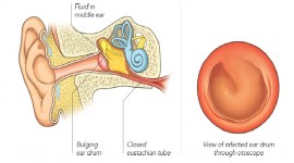 Valley Ear Nose & Throat Centre - Ear Infection Treatment in Nairobi