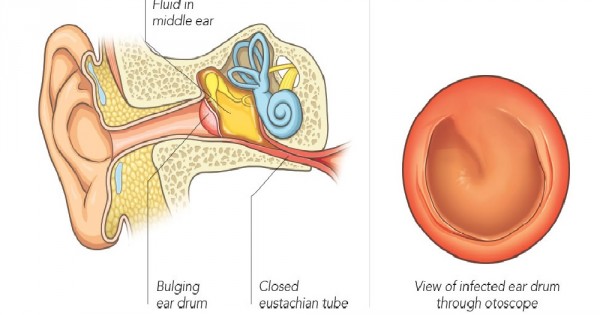 Valley Ear Nose & Throat Centre - Ear Infection Treatment in Nairobi