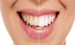 Dr. Amrita Hayer - Cosmetic Dentistry Services in Kisumu