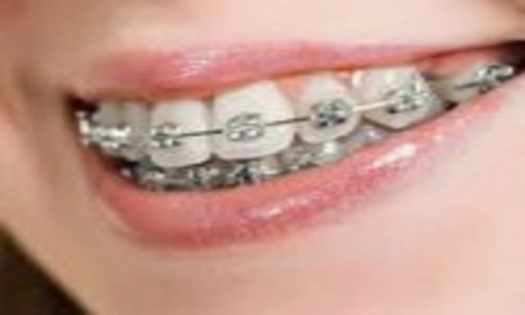 Balm Dental Care Centre  - Affordable Dental Braces in Nairobi