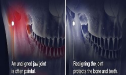 Dental X-Ray & Imaging Centre - TMJ Disorder X-Ray in Kenya