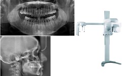 Dental X-Ray & Imaging Centre - OPG X-Ray Services in Kenya