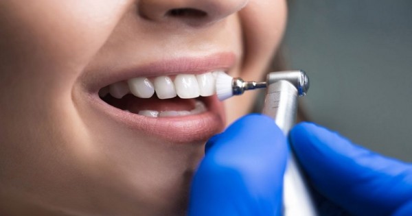 Balm Dental Care Centre  - Benefits of Teeth Cleaning