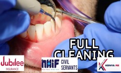 Dove Dental Clinic - Full Mouth Cleaning in Thika