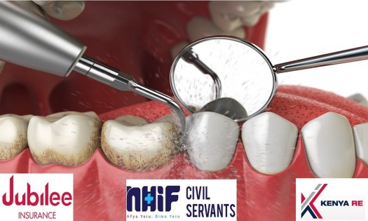 Dove Dental Clinic - Tooth Cleaning in Thika