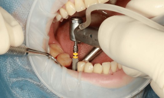 Dove Dental Clinic -  Restorative Dentistry Experts  in Thika