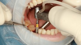 Dove Dental Clinic -  Restorative Dentistry Experts  in Thika