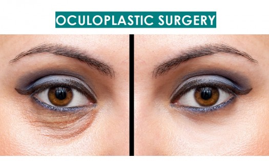 Dr Fredrick Ngugi Kagondu - Ophthalmologist  - OCULOPLASTIC SURGERY IN THIKA