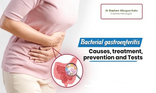 Dr Stephen Mbugua Kairu - BACTERIAL GASTROENTERITIS TREATMENT IN KENYA