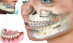 Dental Health Providers Clinics - Maxillofacial Services in Kenya