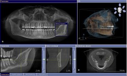 Dental X-Ray & Imaging Centre - DENTAL IMAGING IN KENYA