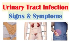 Dr Onyango Oluoch - Urologist - TREATMENT OF URINARY TRACT INFECTION IN NAIROBI
