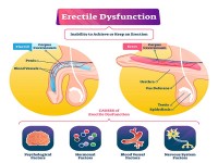 Dr Onyango Oluoch - Urologist - ERECTILE DYSFUNCTION - DIAGNOSIS & TREATMENT IN NAIROBI