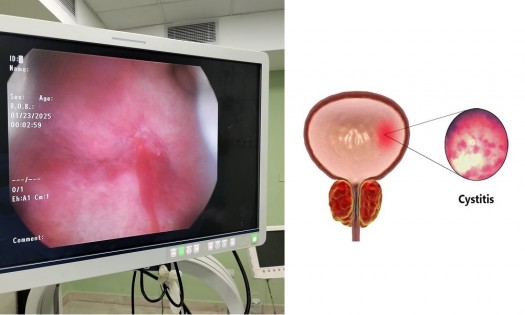 DR ONYANGO OLUOCH - UROLOGIST - Renal Cysts management in Nairobi, Kenya